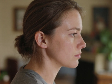 Почему выпадают жирные волосы и что делать с проблемой?