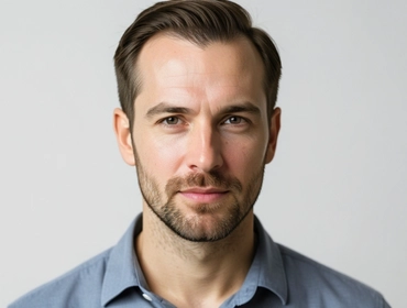 Залысины на висках: в чем причина, что делать